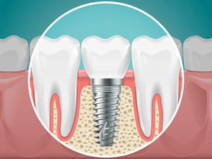 Dr. Robert Madry. Rob Madry DDS. General Dentist, Cosmetic Dentist, Restorative Dentist, Preventative Dentist, Family Dentist. Veneers, Teeth Whitening, Same-Day Crowns, Invisalign, Smile Makeover, Implant Restoration. Dentist in Corpus Christi, TX 78411