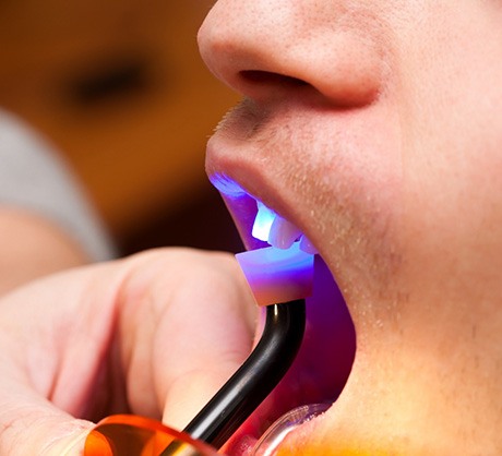 Dr. Robert Madry. Rob Madry DDS. General Dentist, Cosmetic Dentist, Restorative Dentist, Preventative Dentist, Family Dentist. Veneers, Teeth Whitening, Same-Day Crowns, Invisalign, Smile Makeover, Implant Restoration. Dentist in Corpus Christi, TX 78411