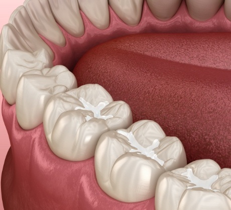 Dr. Robert Madry. Rob Madry DDS. General Dentist, Cosmetic Dentist, Restorative Dentist, Preventative Dentist, Family Dentist. Veneers, Teeth Whitening, Same-Day Crowns, Invisalign, Smile Makeover, Implant Restoration. Dentist in Corpus Christi, TX 78411