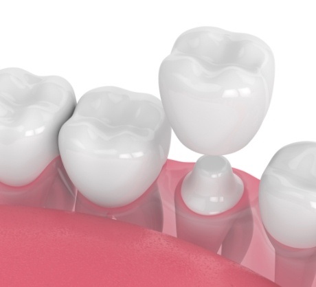 Dr. Robert Madry. Rob Madry DDS. General Dentist, Cosmetic Dentist, Restorative Dentist, Preventative Dentist, Family Dentist. Veneers, Teeth Whitening, Same-Day Crowns, Invisalign, Smile Makeover, Implant Restoration. Dentist in Corpus Christi, TX 78411