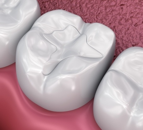Dr. Robert Madry. Rob Madry DDS. General Dentist, Cosmetic Dentist, Restorative Dentist, Preventative Dentist, Family Dentist. Veneers, Teeth Whitening, Same-Day Crowns, Invisalign, Smile Makeover, Implant Restoration. Dentist in Corpus Christi, TX 78411