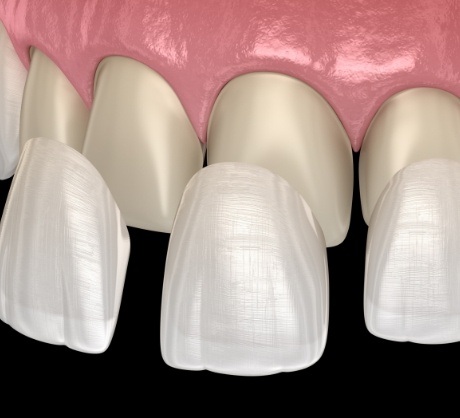 Dr. Robert Madry. Rob Madry DDS. General Dentist, Cosmetic Dentist, Restorative Dentist, Preventative Dentist, Family Dentist. Veneers, Teeth Whitening, Same-Day Crowns, Invisalign, Smile Makeover, Implant Restoration. Dentist in Corpus Christi, TX 78411
