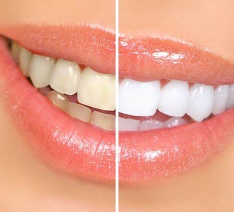 Dr. Robert Madry. Rob Madry DDS. General Dentist, Cosmetic Dentist, Restorative Dentist, Preventative Dentist, Family Dentist. Veneers, Teeth Whitening, Same-Day Crowns, Invisalign, Smile Makeover, Implant Restoration. Dentist in Corpus Christi, TX 78411