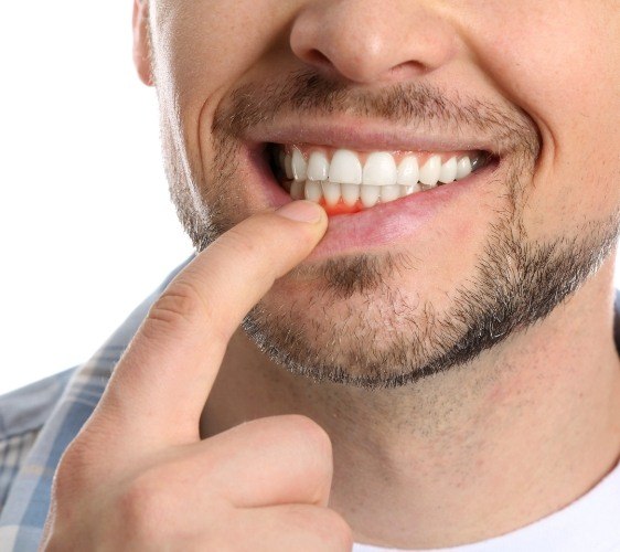 Dr. Robert Madry. Rob Madry DDS. General Dentist, Cosmetic Dentist, Restorative Dentist, Preventative Dentist, Family Dentist. Veneers, Teeth Whitening, Same-Day Crowns, Invisalign, Smile Makeover, Implant Restoration. Dentist in Corpus Christi, TX 78411