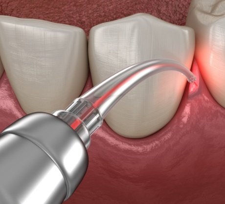 Dr. Robert Madry. Rob Madry DDS. General Dentist, Cosmetic Dentist, Restorative Dentist, Preventative Dentist, Family Dentist. Veneers, Teeth Whitening, Same-Day Crowns, Invisalign, Smile Makeover, Implant Restoration. Dentist in Corpus Christi, TX 78411