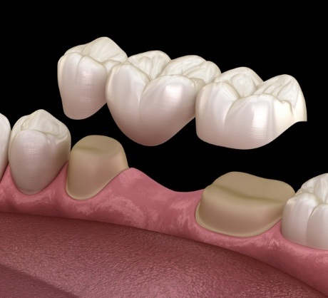 Dr. Robert Madry. Rob Madry DDS. General Dentist, Cosmetic Dentist, Restorative Dentist, Preventative Dentist, Family Dentist. Veneers, Teeth Whitening, Same-Day Crowns, Invisalign, Smile Makeover, Implant Restoration. Dentist in Corpus Christi, TX 78411