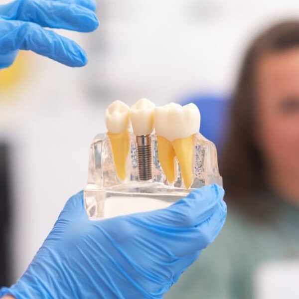 Dr. Robert Madry. Rob Madry DDS. General Dentist, Cosmetic Dentist, Restorative Dentist, Preventative Dentist, Family Dentist. Veneers, Teeth Whitening, Same-Day Crowns, Invisalign, Smile Makeover, Implant Restoration. Dentist in Corpus Christi, TX 78411