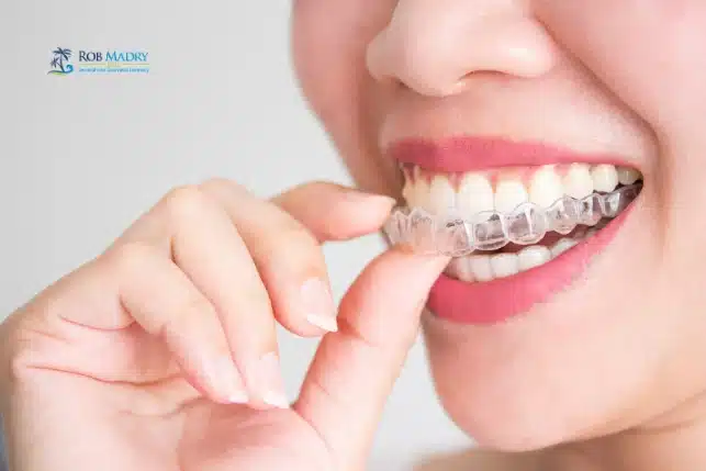 Woman inserting Invisalign clear aligners while following What Patients Should Know About Invisalign - Rob Madry DDS.