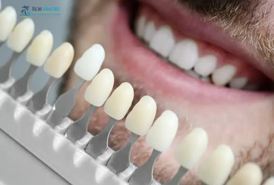 Cosmetic dentistry options for a brighter smile before big life events