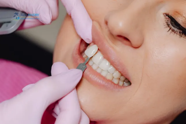 How long cosmetic bonding lasts with proper dental care