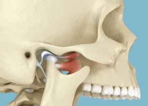 Skull anatomy of where TMJ Pain originates