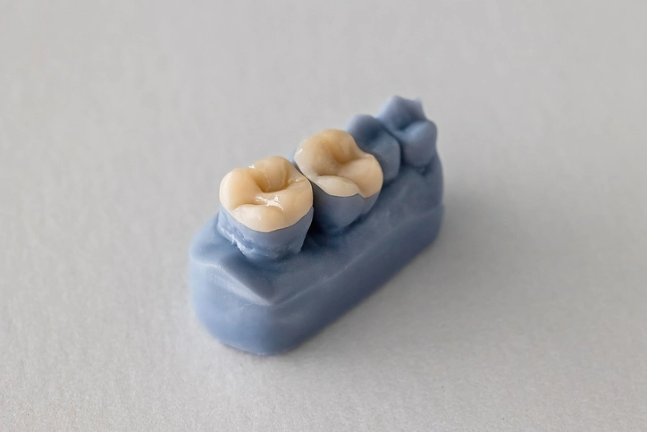 display of two dental crowns in natural tooth color